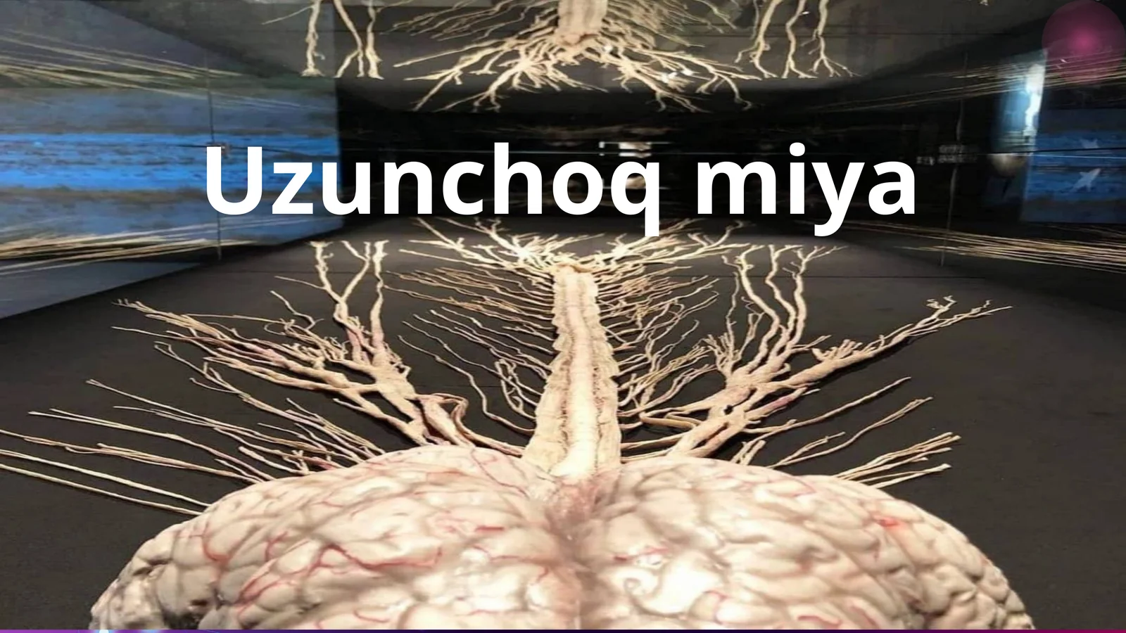 Uzunchoqmiya